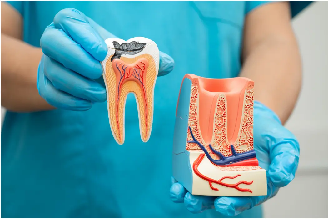 Root Canal Treatment