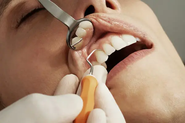 Tooth Extraction